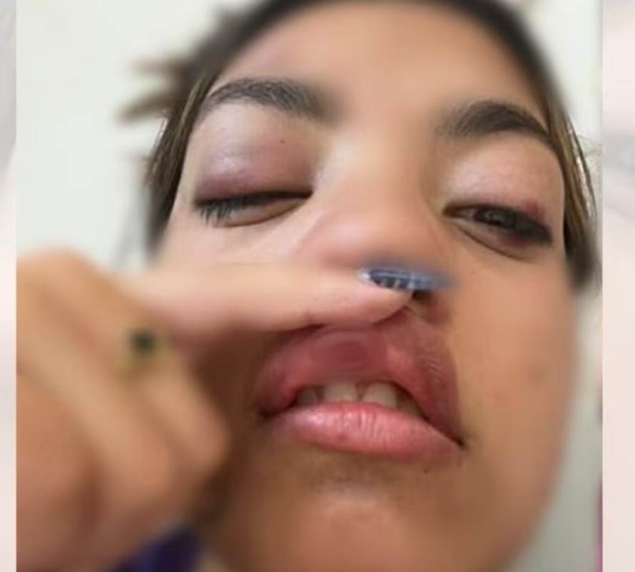 Violenta emboscada callejera contra una adolescente para robarle sus pertenencias tras una salida&nbsp;nocturna